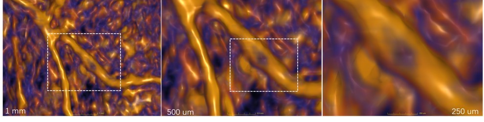 微觀血管結(jié)構(gòu)成像.jpg