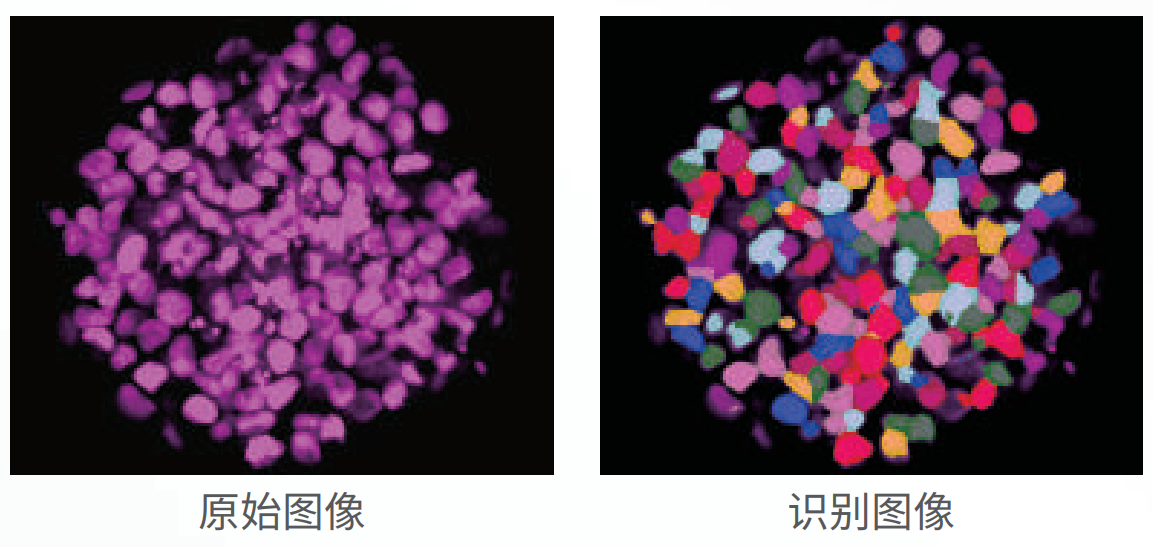 應(yīng)用3：類器官、球體成像.png